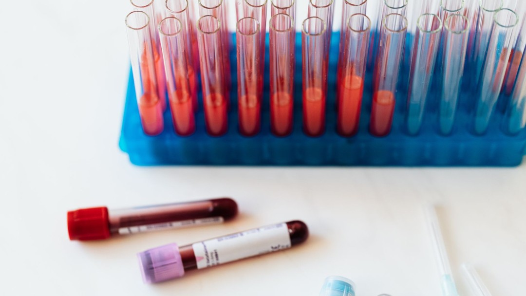 用4%股权换2.6亿美元:ToleranceBio的胸腺再生赌注